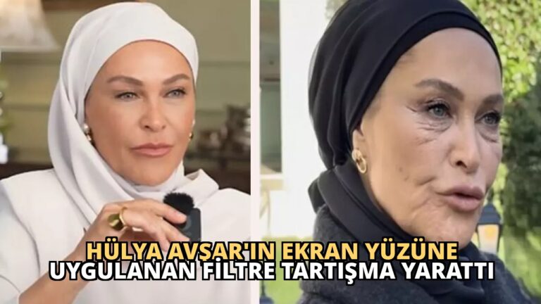 Hülya Avşar’ın Ekran Yüzüne Uygulanan Filtre Tartışma Yarattı